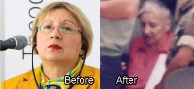 Leyla before after